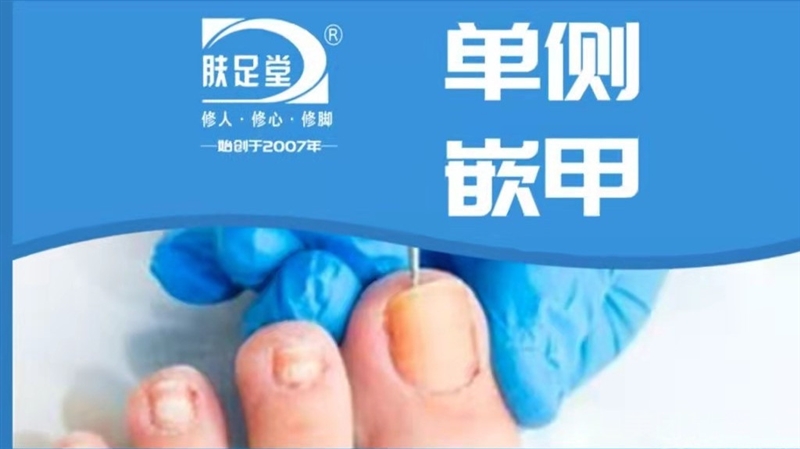肤足堂灰指甲·甲沟炎·鸡眼（建国西路店）的图标