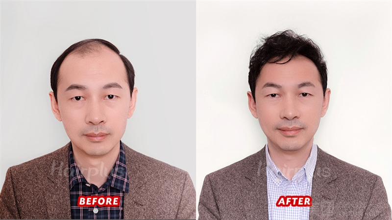 美丝珈Hairplus日式轻增发（苏宁店）的图标